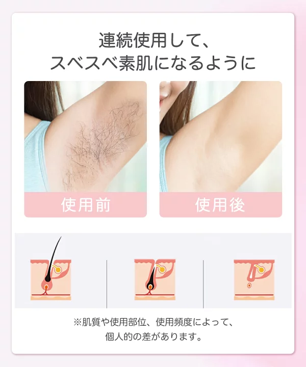 7 (1).webp