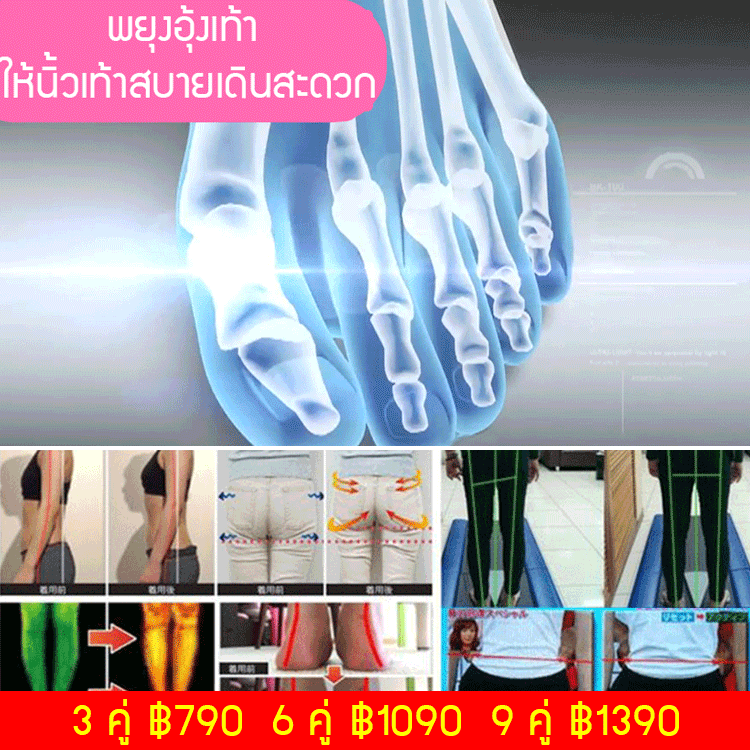 ถุงเท้า 5 นิ้วปรับรูปเท้า