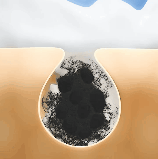 20240117_095149_027.gif