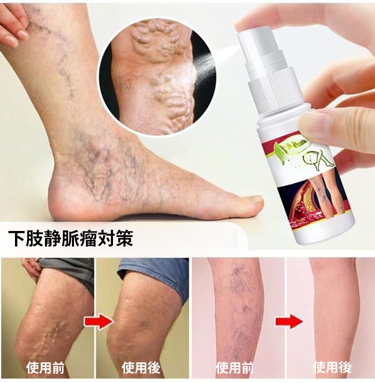 静脉喷雾JP_05.jpg