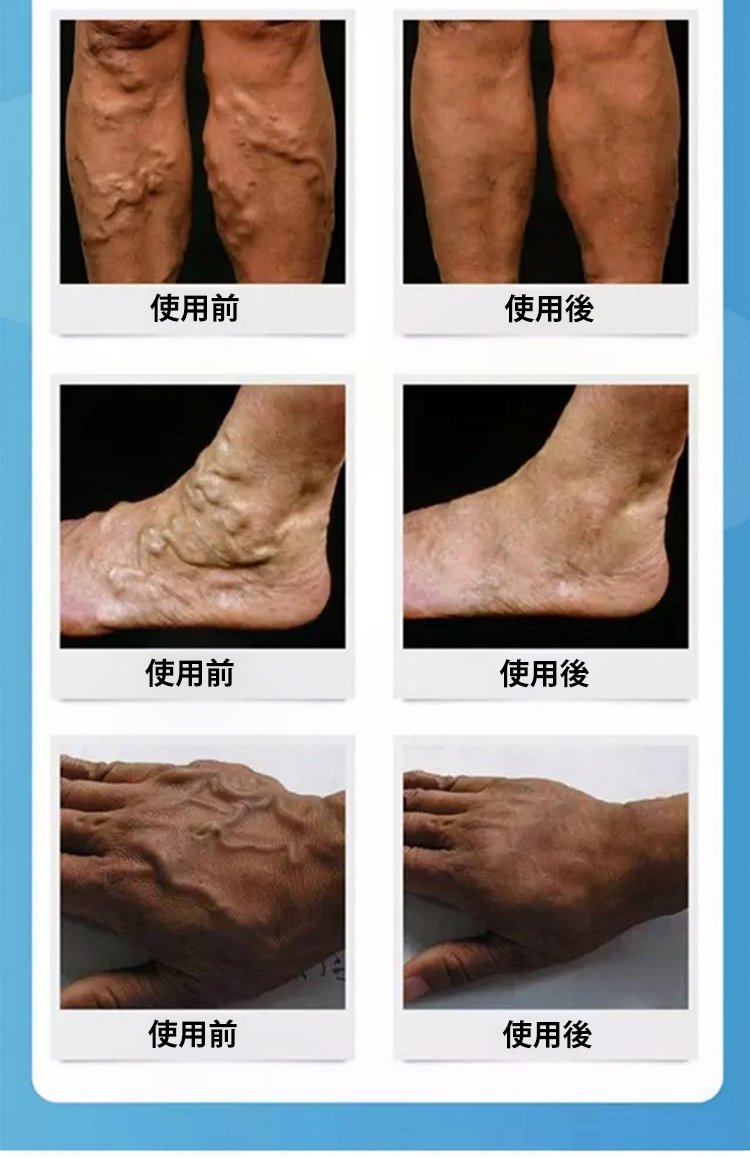 静脉喷雾JP_40.jpg
